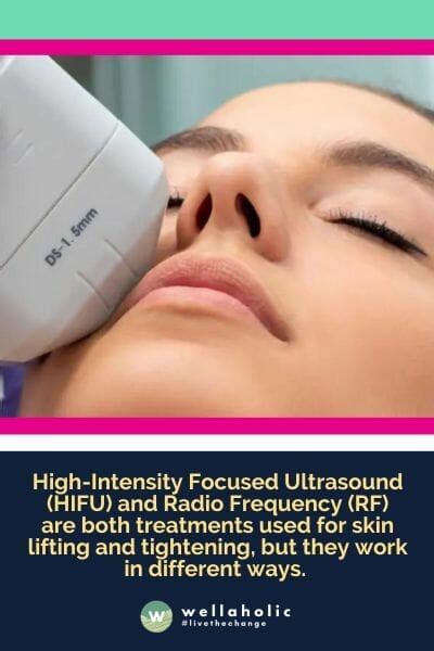 vmax hifu vs hifu|RF Vlift vs HIFU .